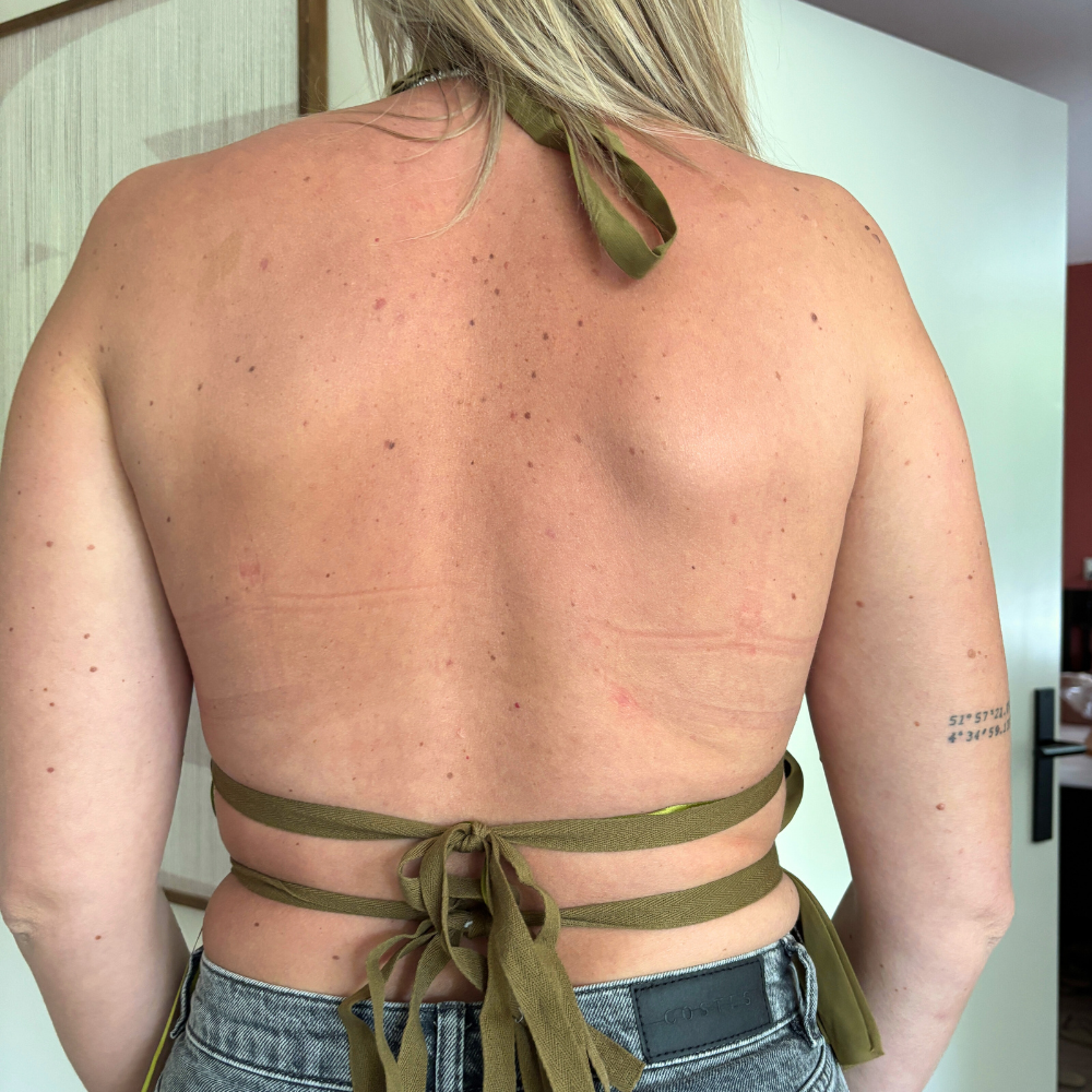 Halter top met open rug